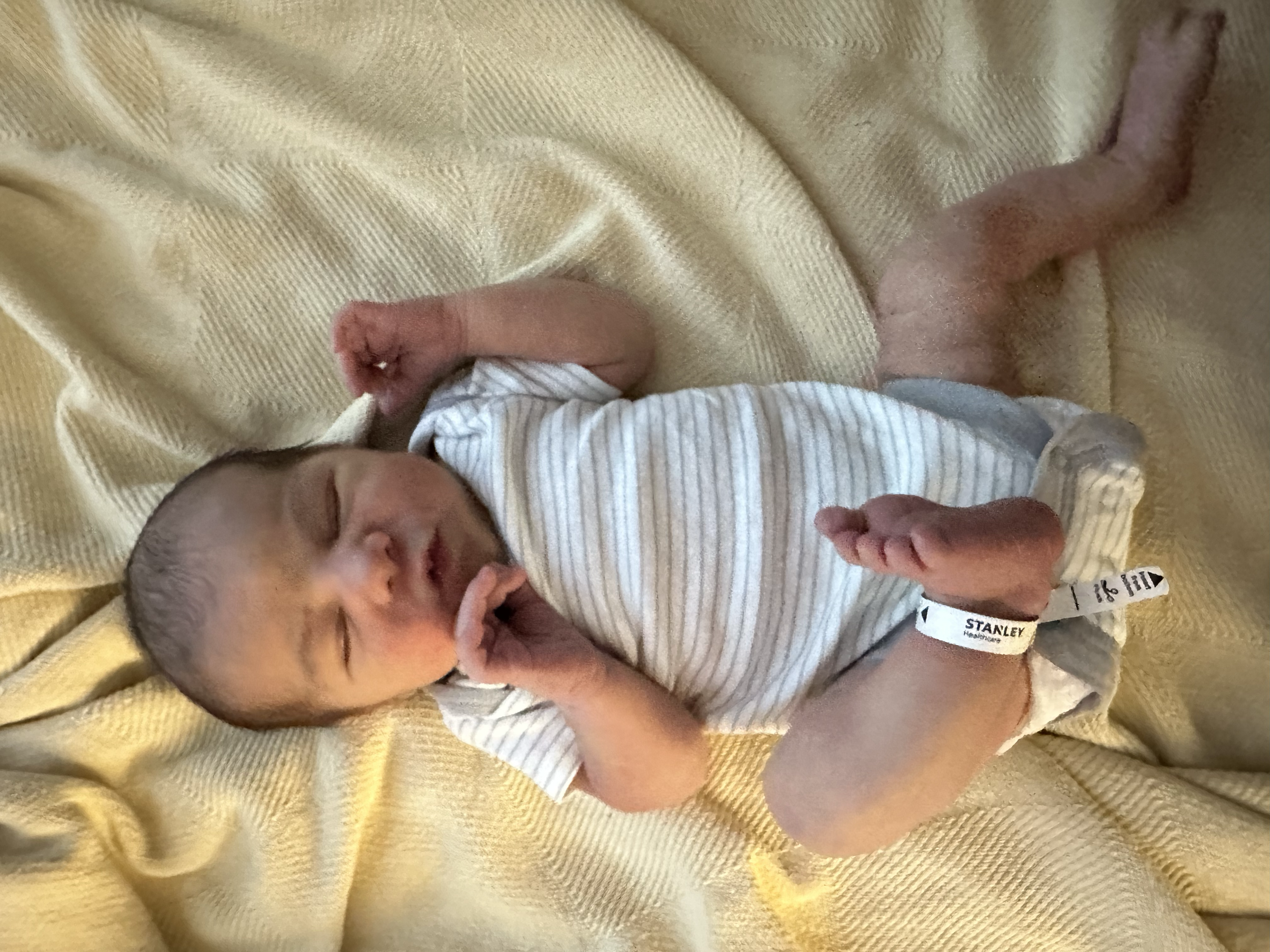 Zoe the day after she was born, on a hospital bed